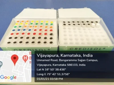 ALLERGIC SKIN PRICK TEST