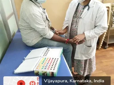 ALLERGIC SKIN PRICK TEST