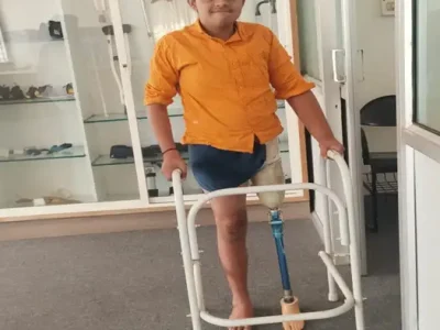 ARTIFICIAL LIMB
