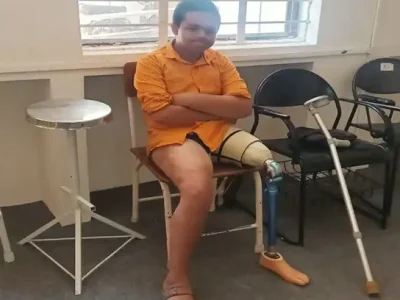 ARTIFICIAL LIMB