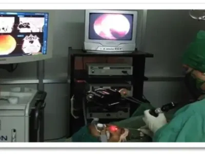 NAVIGATION GUIDED SKULL BASE SURGERY