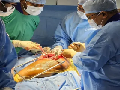 OPERATION THEATRE