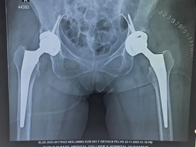 OPERATION THEATRE