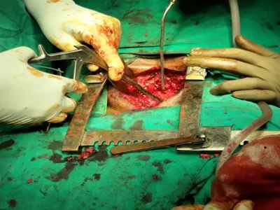 OPERATION THEATRE